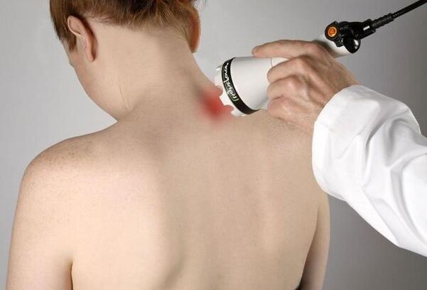 Terapia a laser